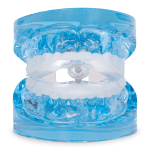 myTAP: Precision Fit Oral Appliance