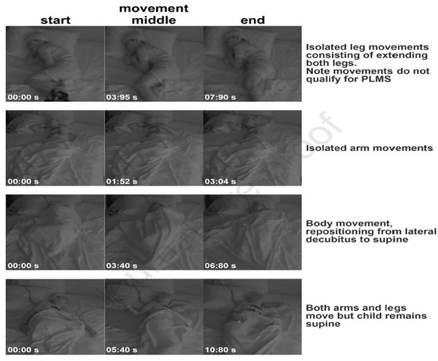 ARE WE OVERMEDICATING OUR CHILDREN?