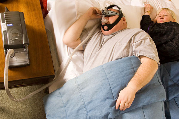 Can Being Overweight Cause Sleep Apnea?